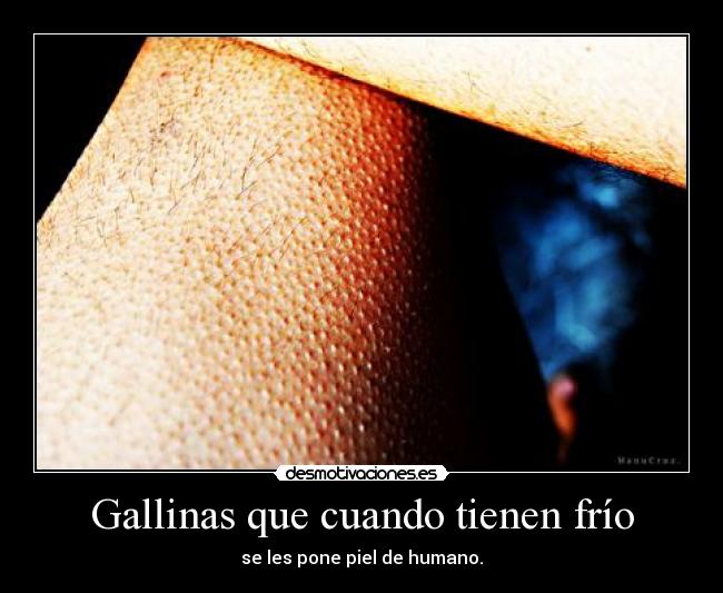 Gallinas que cuando tienen frío - se les pone piel de humano.