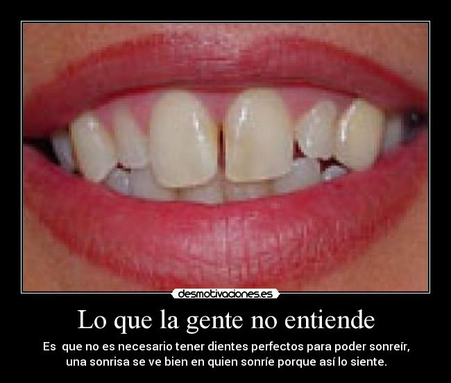 Lo que la gente no entiende - Es  que no es necesario tener dientes perfectos para poder sonreír,
una sonrisa se ve bien en quien sonríe porque así lo siente.