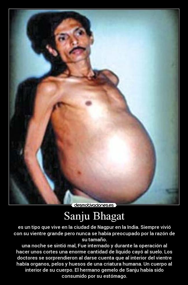 Sanju Bhagat -
