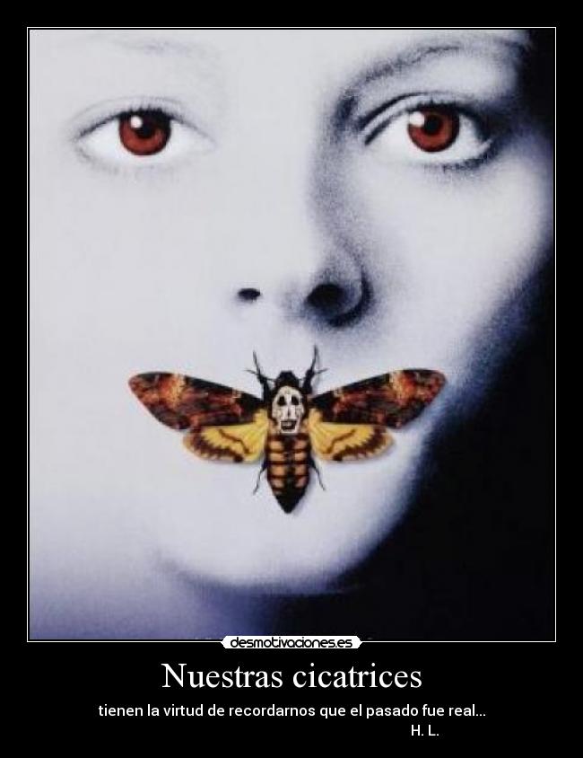Nuestras cicatrices - tienen la virtud de recordarnos que el pasado fue real...
H. L.