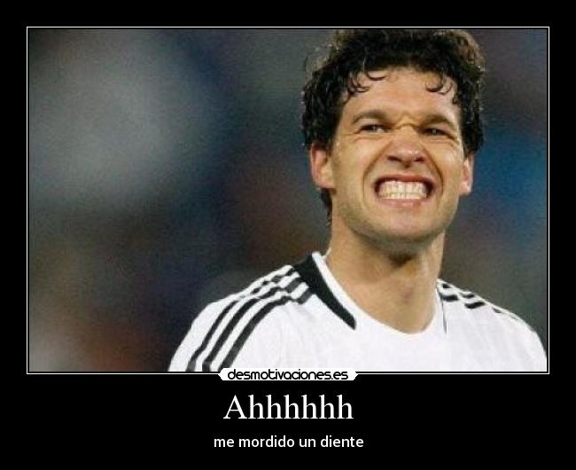 Ahhhhhh - me mordido un diente