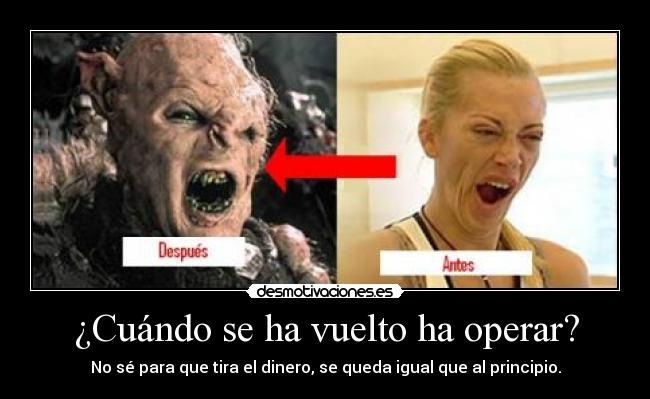 ¿Cuándo se ha vuelto ha operar? - No sé para que tira el dinero, se queda igual que al principio.