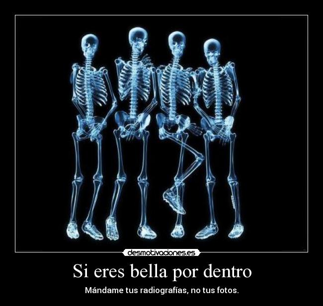 carteles resubido arreglado belleza fealdad fotos radiografia medicina desmotivaciones