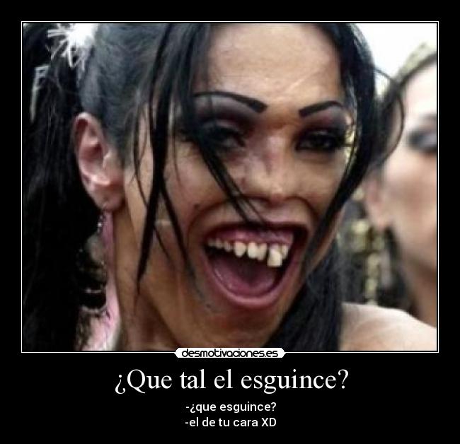 ¿Que tal el esguince? - -¿que esguince?
-el de tu cara XD