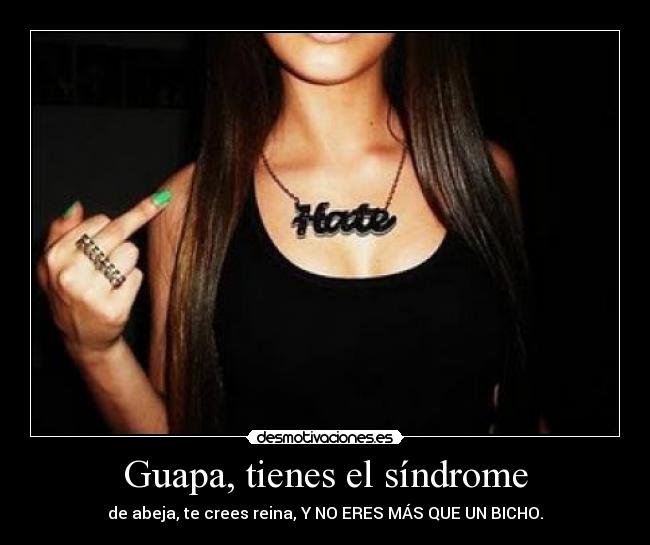 Guapa, tienes el síndrome -