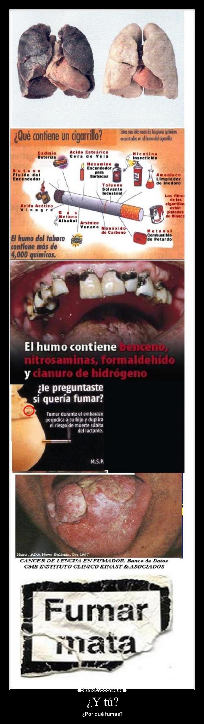 ¿Y tú? - ¿Por qué fumas?