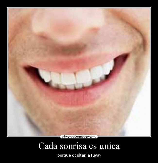 Cada sonrisa es unica - porque ocultar la tuya?