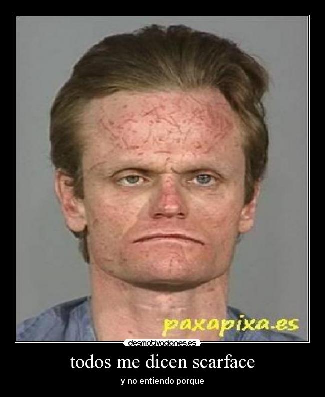 todos me dicen scarface - y no entiendo porque