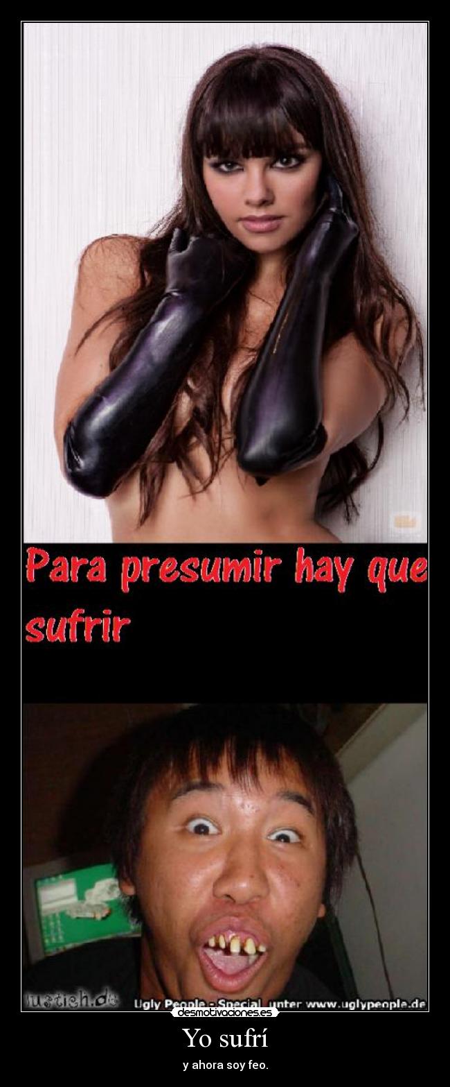 Yo sufrí - y ahora soy feo.