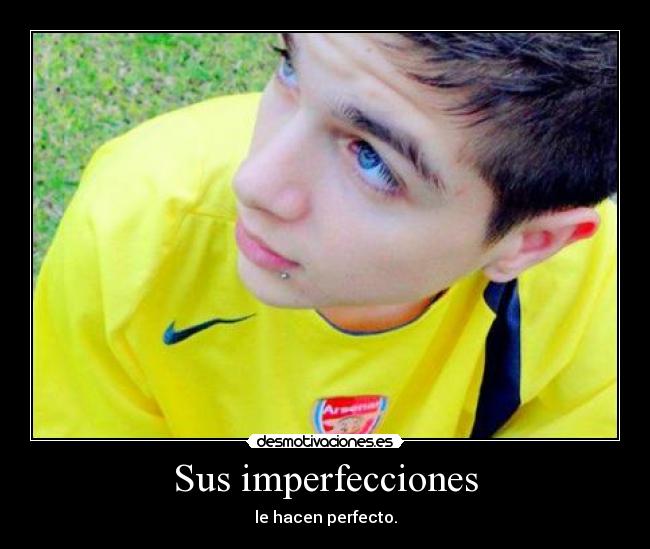 Sus imperfecciones - le hacen perfecto.