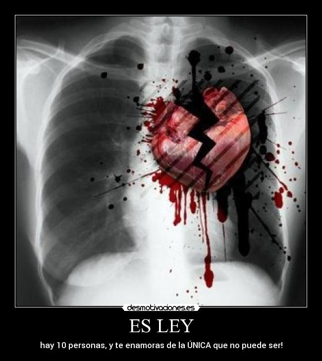 ES LEY - 