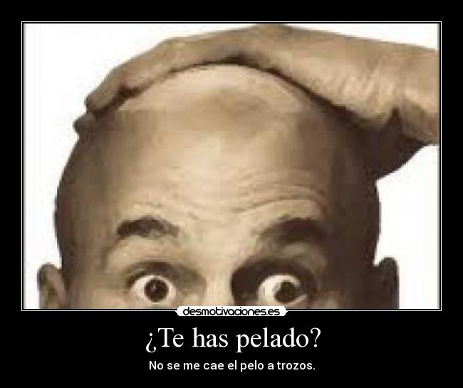 ¿Te has pelado? - No se me cae el pelo a trozos.