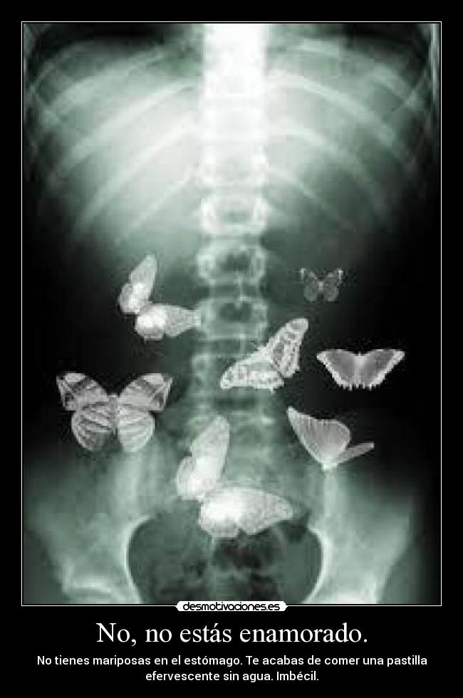 No, no estás enamorado. - No tienes mariposas en el estómago. Te acabas de comer una pastilla
efervescente sin agua. Imbécil.