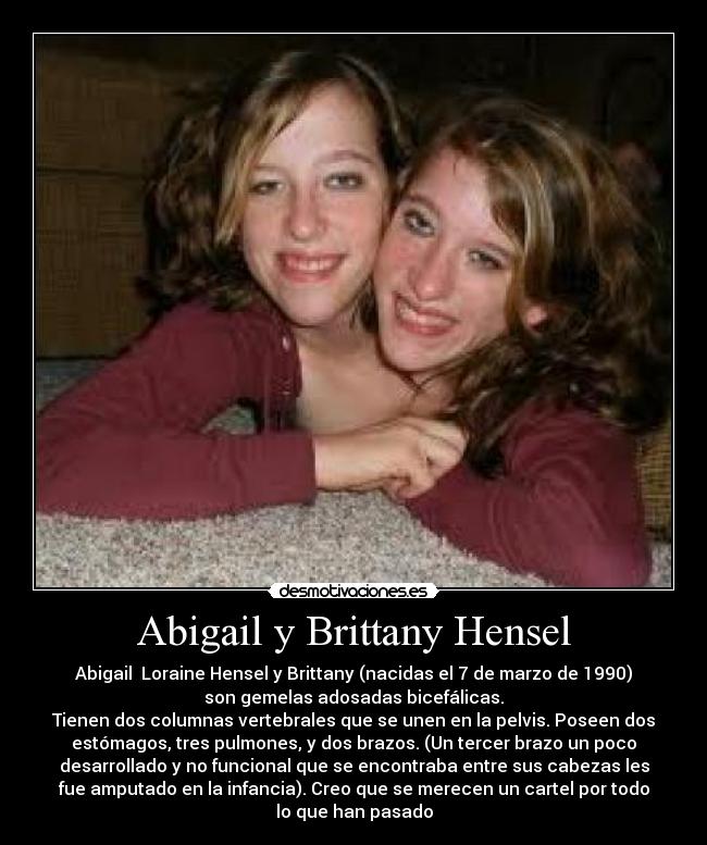 Abigail y Brittany Hensel - Abigail  Loraine Hensel y Brittany (nacidas el 7 de marzo de 1990)
son gemelas adosadas bicefálicas.
Tienen dos columnas vertebrales que se unen en la pelvis. Poseen dos
estómagos, tres pulmones, y dos brazos. (Un tercer brazo un poco
desarrollado y no funcional que se encontraba entre sus cabezas les
fue amputado en la infancia). Creo que se merecen un cartel por todo
lo que han pasado