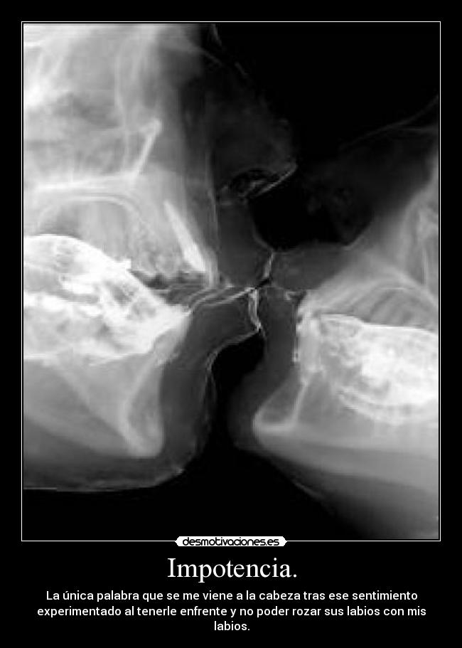 Impotencia. - La única palabra que se me viene a la cabeza tras ese sentimiento
experimentado al tenerle enfrente y no poder rozar sus labios con mis
labios.