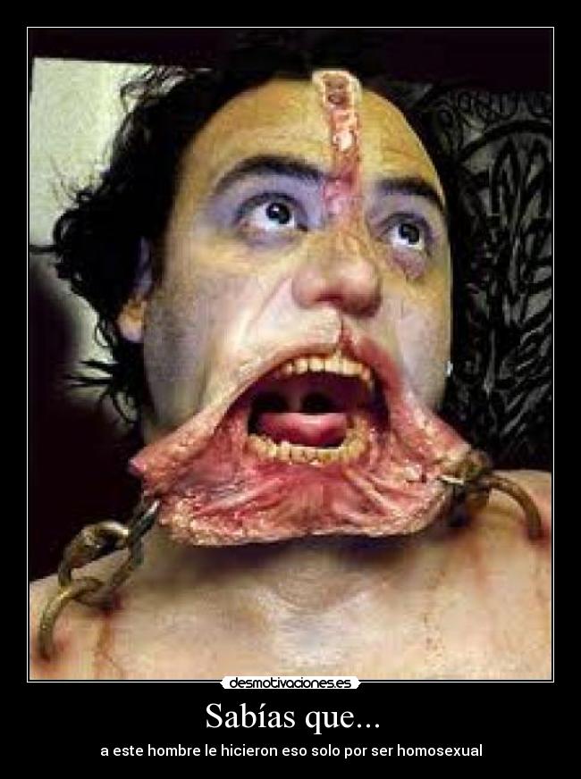 Sabías que... - a este hombre le hicieron eso solo por ser homosexual