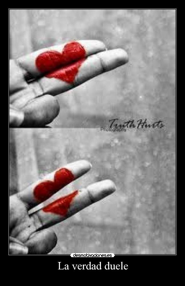 La verdad duele -