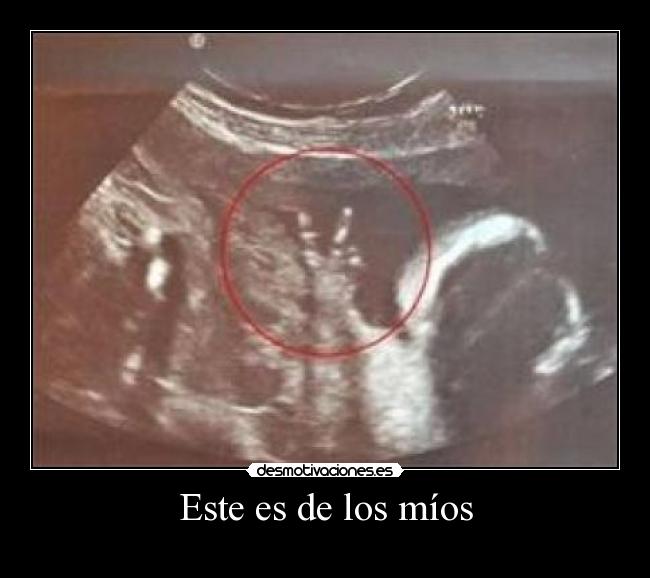 Este es de los míos -