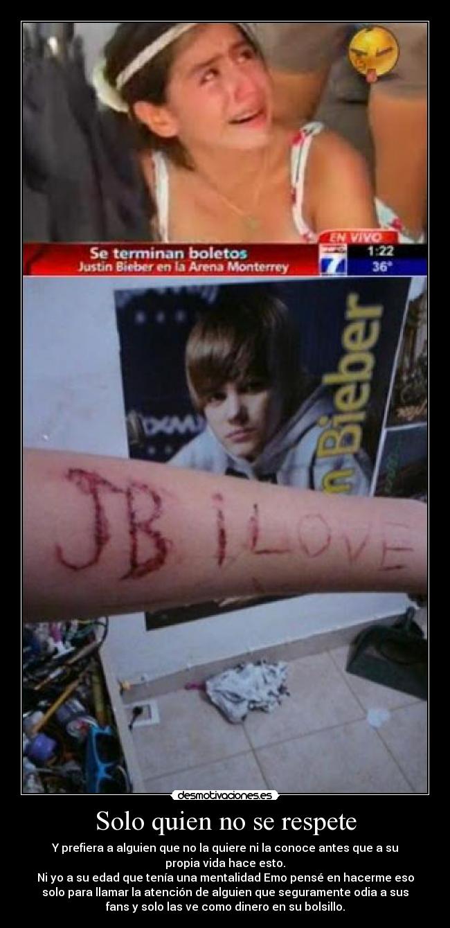 Solo quien no se respete - Y prefiera a alguien que no la quiere ni la conoce antes que a su
propia vida hace esto.
Ni yo a su edad que tenía una mentalidad Emo pensé en hacerme eso
solo para llamar la atención de alguien que seguramente odia a sus
fans y solo las ve como dinero en su bolsillo.
