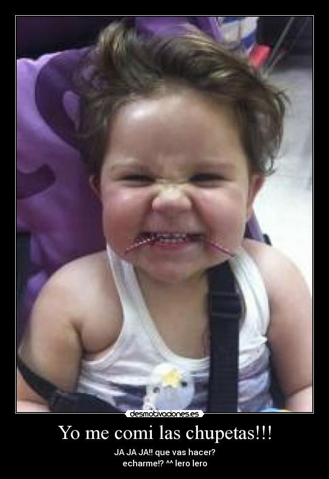 Yo me comi las chupetas!!! - JA JA JA!! que vas hacer?
echarme!? ^^ lero lero