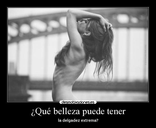 ¿Qué belleza puede tener -