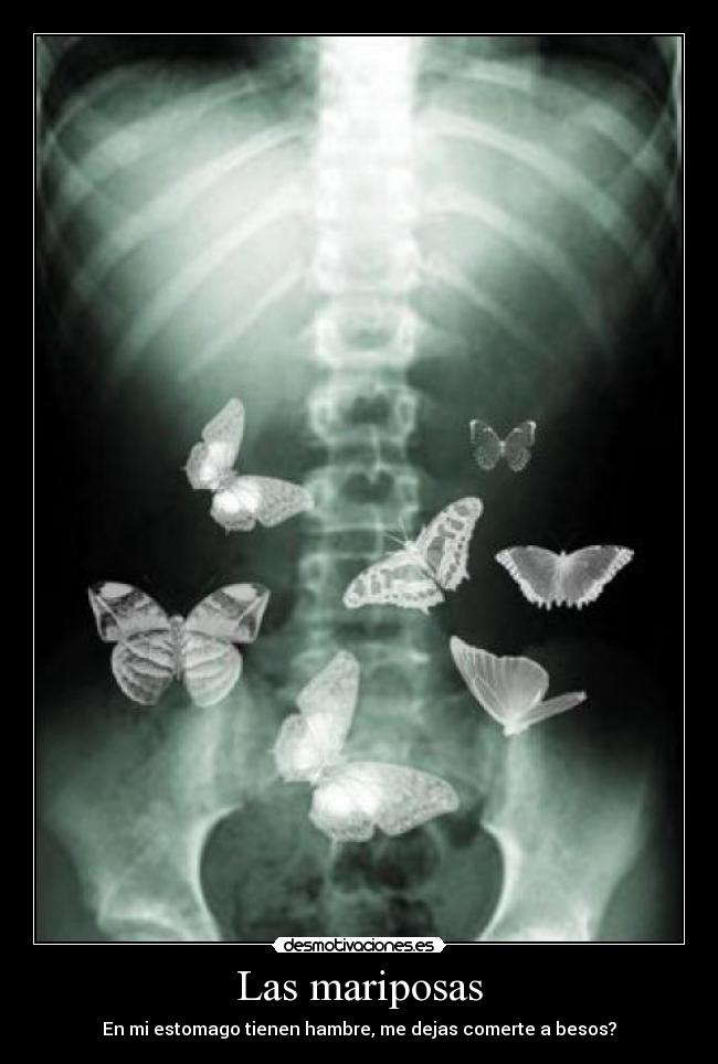 Las mariposas - En mi estomago tienen hambre, me dejas comerte a besos?
