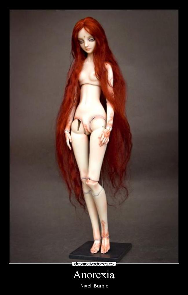 Anorexia - Nivel: Barbie