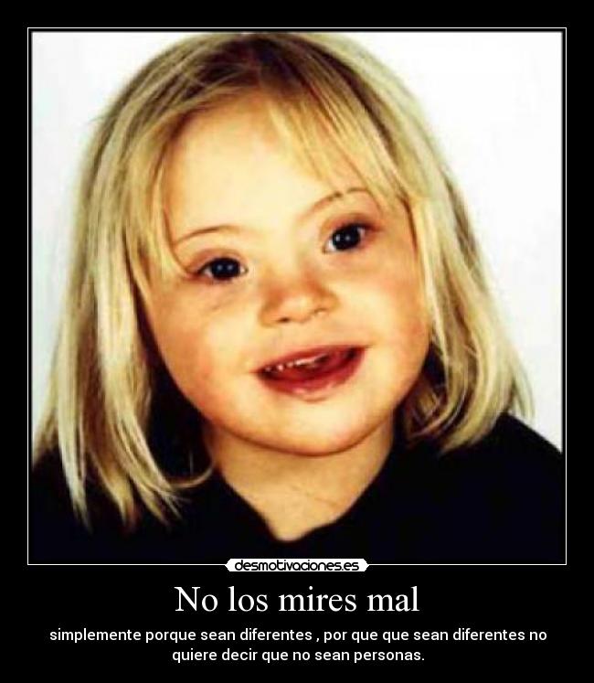 No los mires mal - simplemente porque sean diferentes , por que que sean diferentes no
quiere decir que no sean personas.