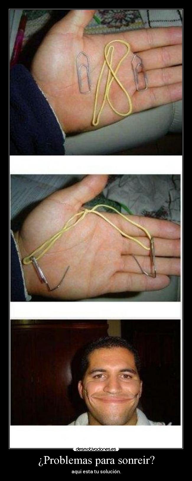 ¿Problemas para sonreir? - 