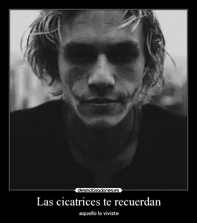 Las cicatrices te recuerdan - aquello lo viviste