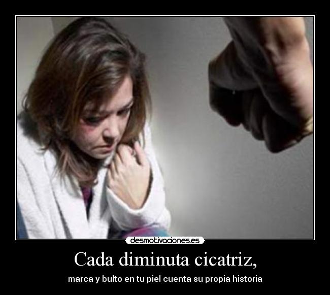 Cada diminuta cicatriz, -