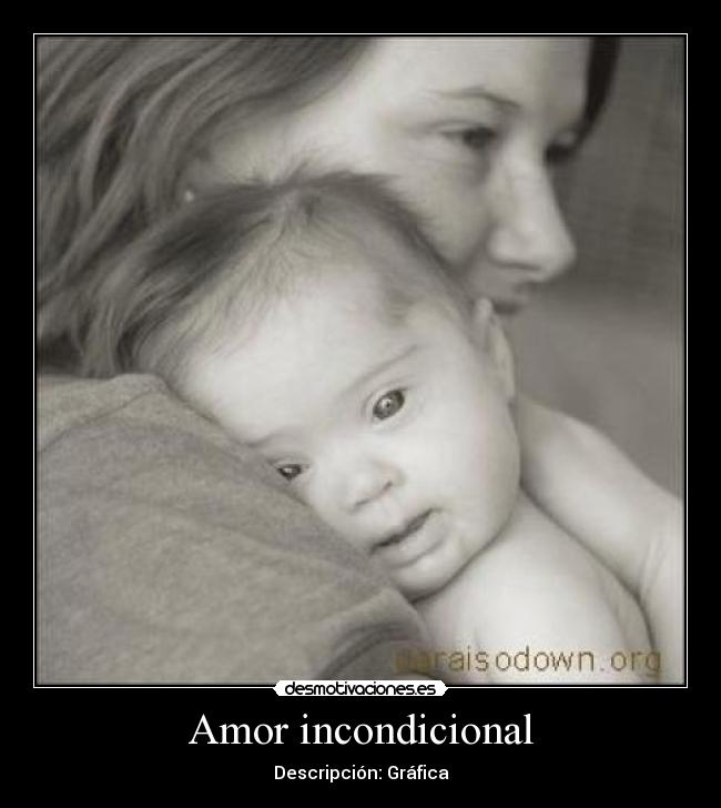 Amor incondicional -