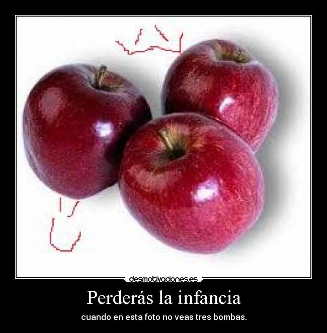 Perderás la infancia - cuando en esta foto no veas tres bombas.