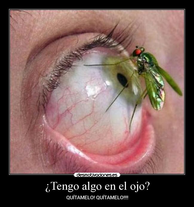 ¿Tengo algo en el ojo? - 