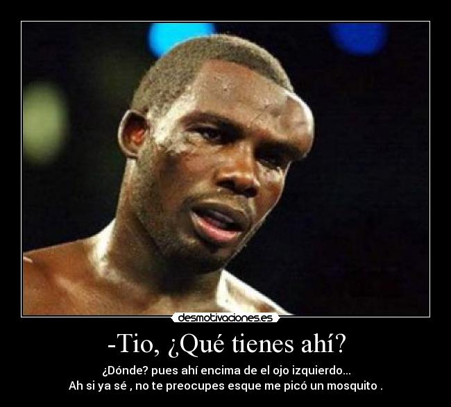 -Tio, ¿Qué tienes ahí? - ¿Dónde? pues ahí encima de el ojo izquierdo...
Ah si ya sé , no te preocupes esque me picó un mosquito .