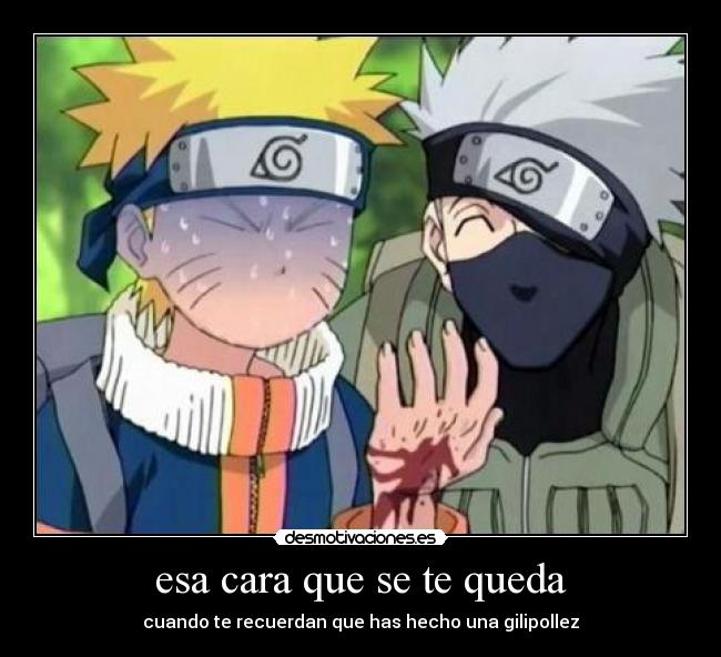 esa cara que se te queda - cuando te recuerdan que has hecho una gilipollez