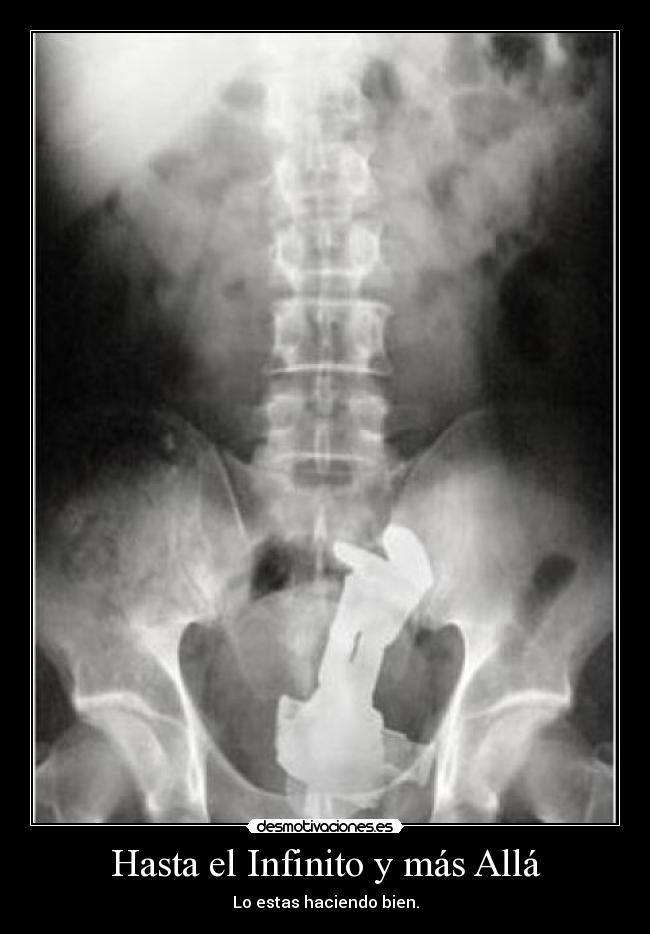 Hasta el Infinito y más Allá - Lo estas haciendo bien.