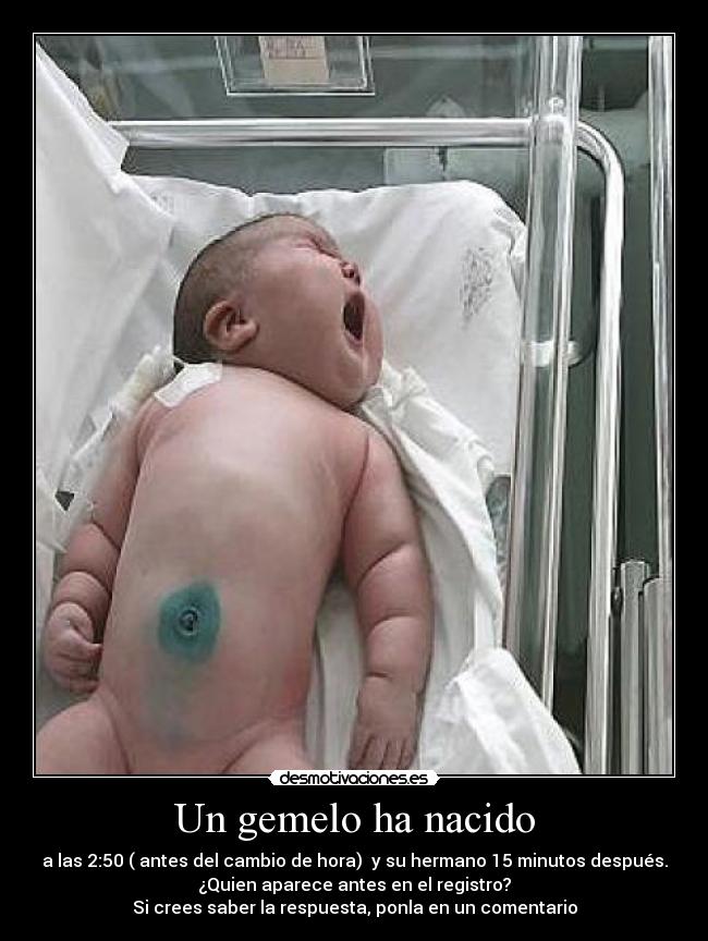 Un gemelo ha nacido -