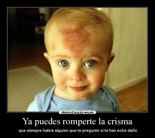 Ya puedes romperte la crisma - 