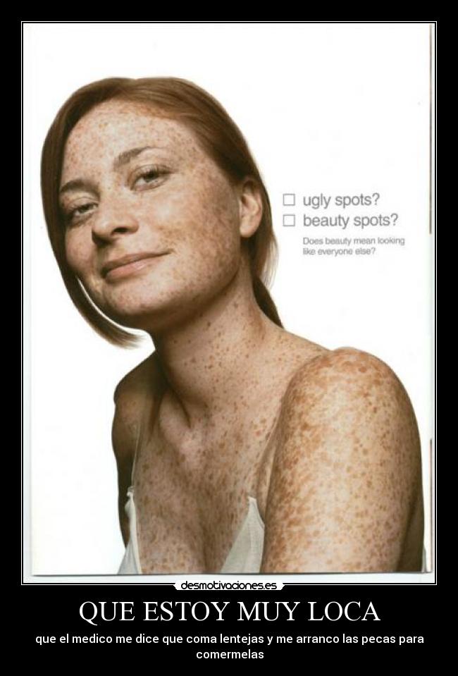 QUE ESTOY MUY LOCA - que el medico me dice que coma lentejas y me arranco las pecas para comermelas