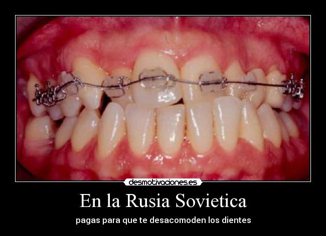 En la Rusia Sovietica - pagas para que te desacomoden los dientes