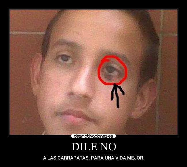 DILE NO - 