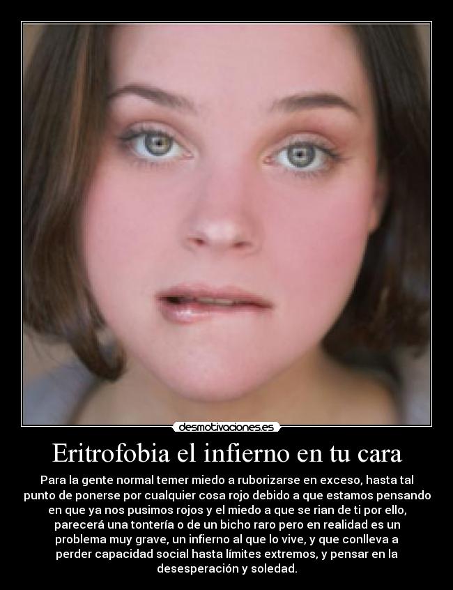 Eritrofobia el infierno en tu cara -