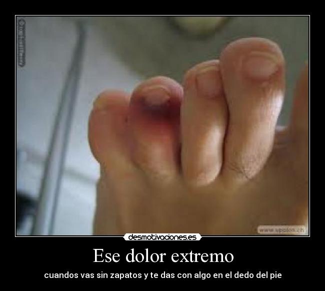 Ese dolor extremo -