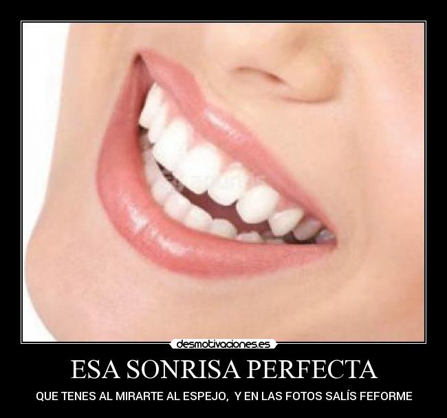 ESA SONRISA PERFECTA -