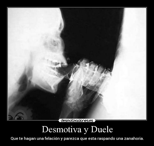 carteles duele desmotivaciones