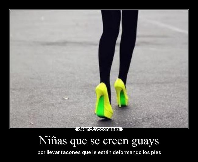 Niñas que se creen guays - por llevar tacones que le están deformando los pies