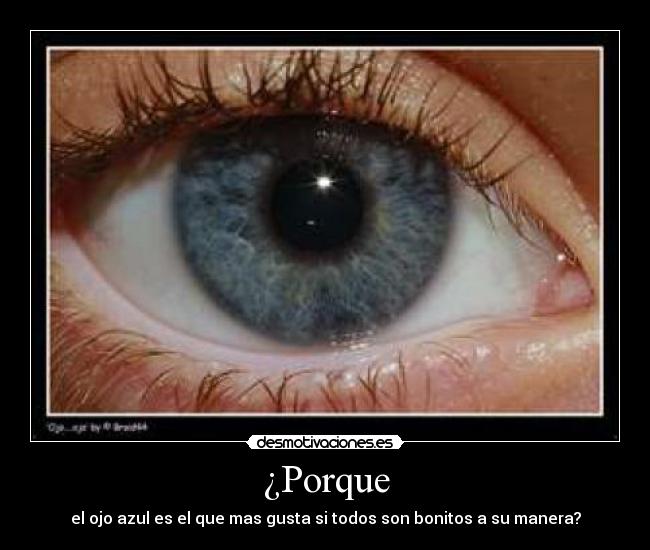 ¿Porque - el ojo azul es el que mas gusta si todos son bonitos a su manera?