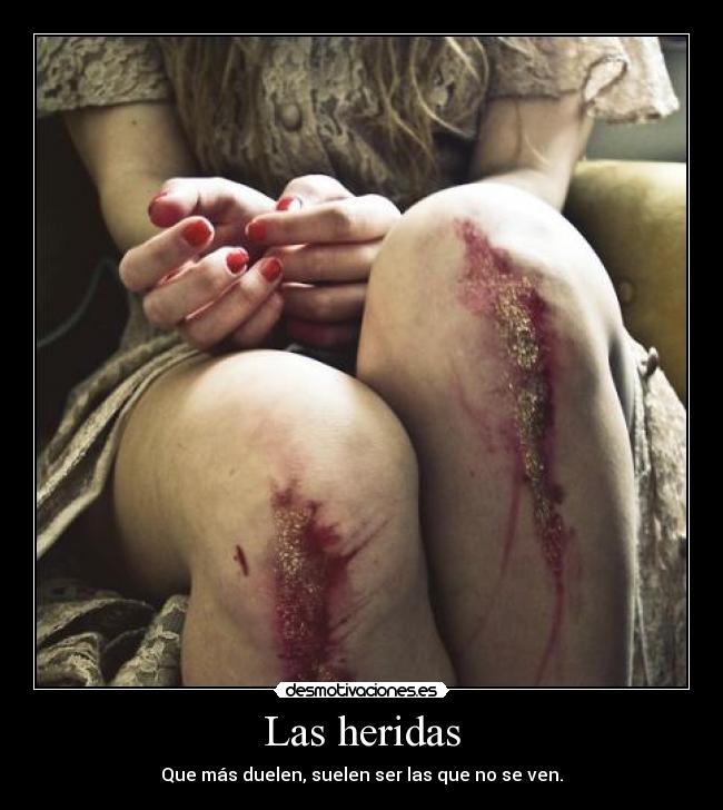 Las heridas - Que más duelen, suelen ser las que no se ven.