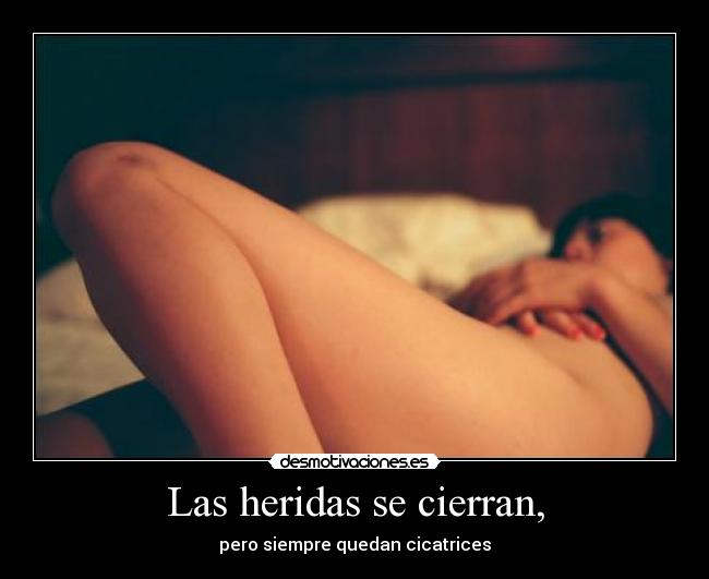 Las heridas se cierran, - pero siempre quedan cicatrices